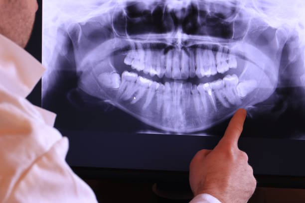 Best Urgent Care for Lost Fillings or Crowns in Quinnipiac University, CT